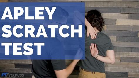 scratch test on the back|apley's scratch test positive.